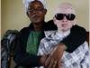 Herzliche Einladung zur Filmvorführung am Internationalen Tag der Aufklärung über Albinismus-2