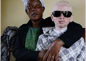 Herzliche Einladung zur Filmvorführung am Internationalen Tag der Aufklärung über Albinismus-1